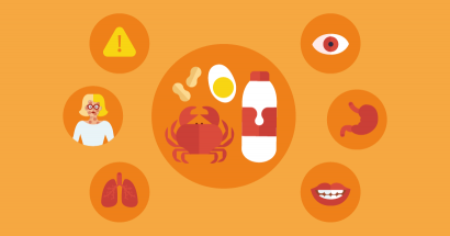Food allergy (Infographic)